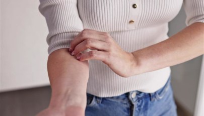 Herpes Zoster, perché è pericoloso per la salute e come si può prevenire