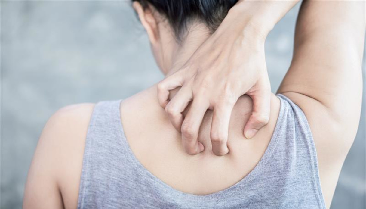 Herpes Zoster, chi è a rischio e come si può prevenire