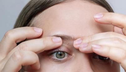 Grani di miglio,  come contrastarli e prevenire la ricomparsa con la beauty routine consigliata dall’esperto