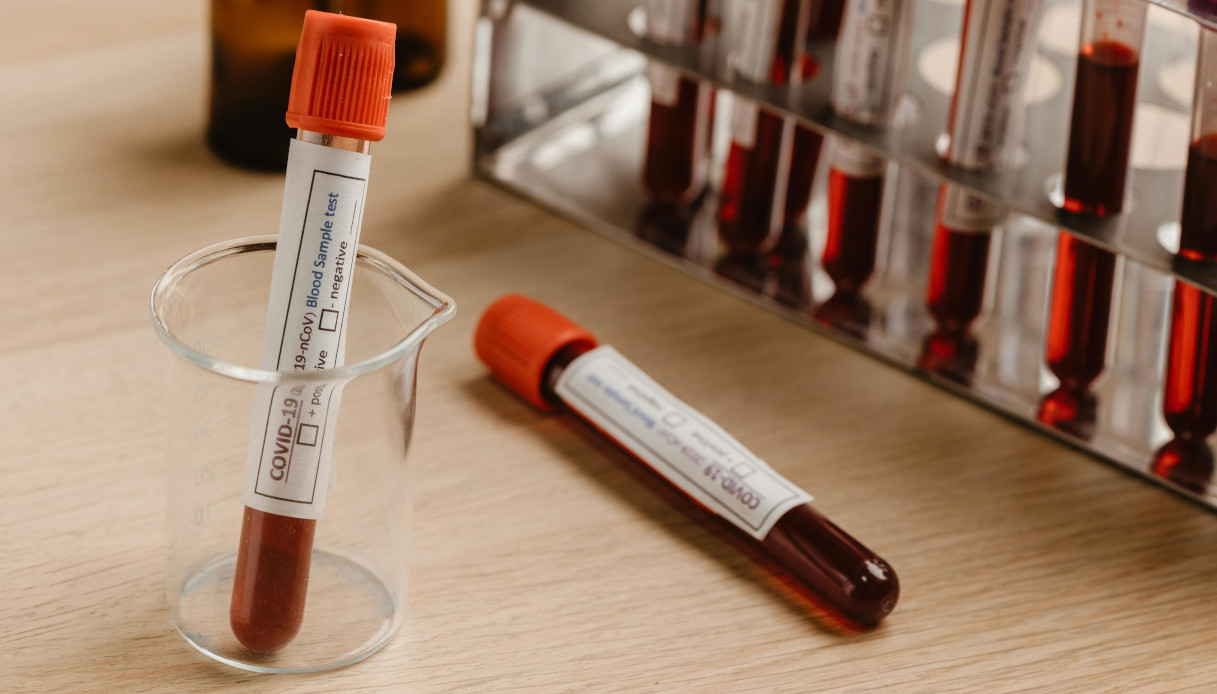 Mielofibrosi, cos’è e come si affronta questa malattia del sangue