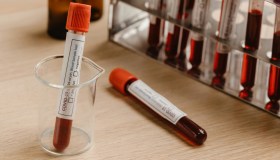 Mielofibrosi, cos’è e come si affronta questa malattia del sangue