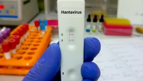 Hantavirus, fino a quando durerà l’allerta, le precauzioni e i dubbi sugli asintomatici