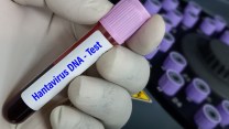 Hantavirus, rischi, mascherine, quarantena: le indicazioni del ministero della Salute