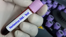 Hantavirus, rischi, mascherine, quarantena: le indicazioni del ministero della Salute