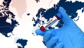Da Hantavirus a ebola, allarme OMS: rischio pandemia a breve. Nuovo caso hantavirus a Milano