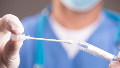 Hantavirus, cos’è, come si contrae, che malattia può dare