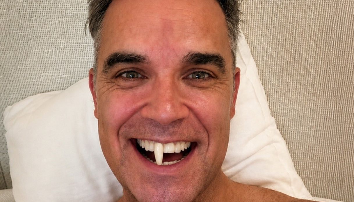 Robbie Williams perde un dente: sui social il racconto dell’intervento andato male
