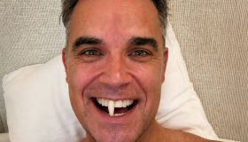 Robbie Williams perde un dente: sui social il racconto dell’intervento andato male