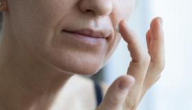Zona baffetti più scura: i rimedi dell’esperto per prevenire e curare il melasma d’estate