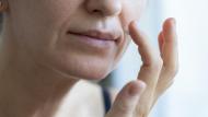 Zona baffetti più scura: i rimedi dell’esperto per prevenire e curare il melasma d’estate