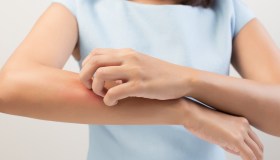 Prurito addio, esiste l’interruttore nel cervello per spegnerlo