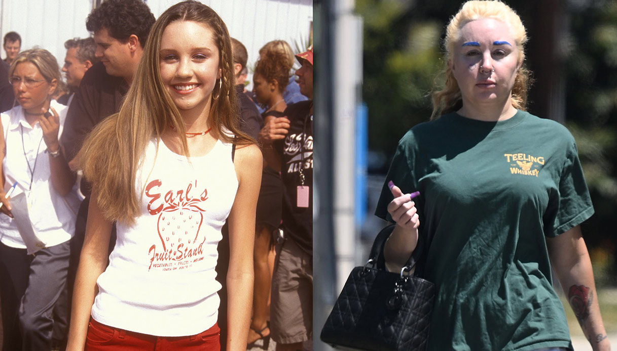 Amanda Bynes prima e dopo 