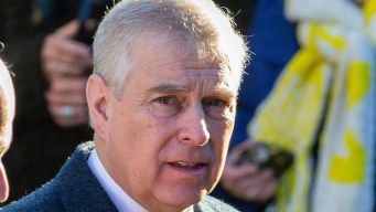 Andrea Mountbatten-Windsor, il livido misterioso sul volto: “Imbarazzato”