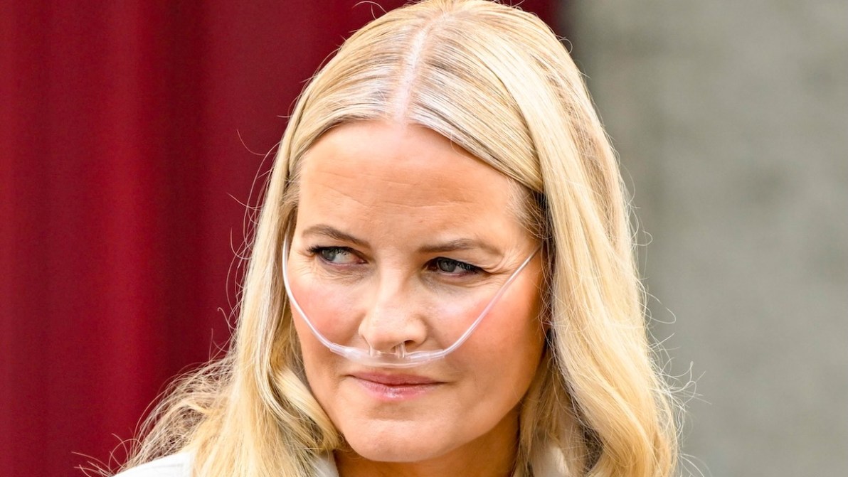 Mette-Marit di Norvegia sottoposta al trapianto di polmone: come è andato l’intervento