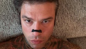 “Dimissioni vicine”, le ultime notizie su Fedez in ospedale: come sta il rapper