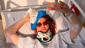 Noemi mostra il livido sulla gamba dopo la caduta: musica e lettura in ospedale