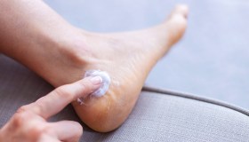 Piedi screpolati, cinque regole per aiutare il benessere della pelle