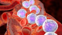 Leucemia linfoblastica acuta, cos’è, chi colpisce e come si affronta