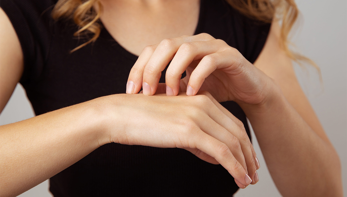 Dermatofilosi o malattia della pioggia, perché può colpire anche l’uomo, come si manifesta e si affronta