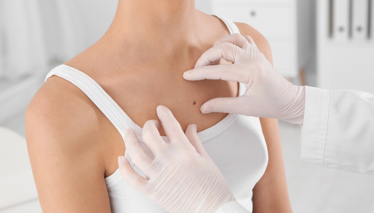 Melanoma, le nuove cure: dal vaccino anti-recidiva alla pillola che spoglia le cellule tumorali